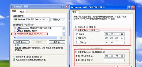 b-設置本地的IP地址