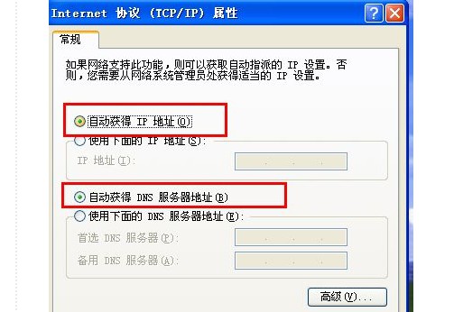 f-自動獲取IP地址和自動獲得DNS服務器地址